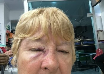LA DOCENTE RUBY OROZCO RELATÓ CÓMO OCURRIÓ EL INTENTO DE ATRACO DEL QUE FUE VÍCTIMA.